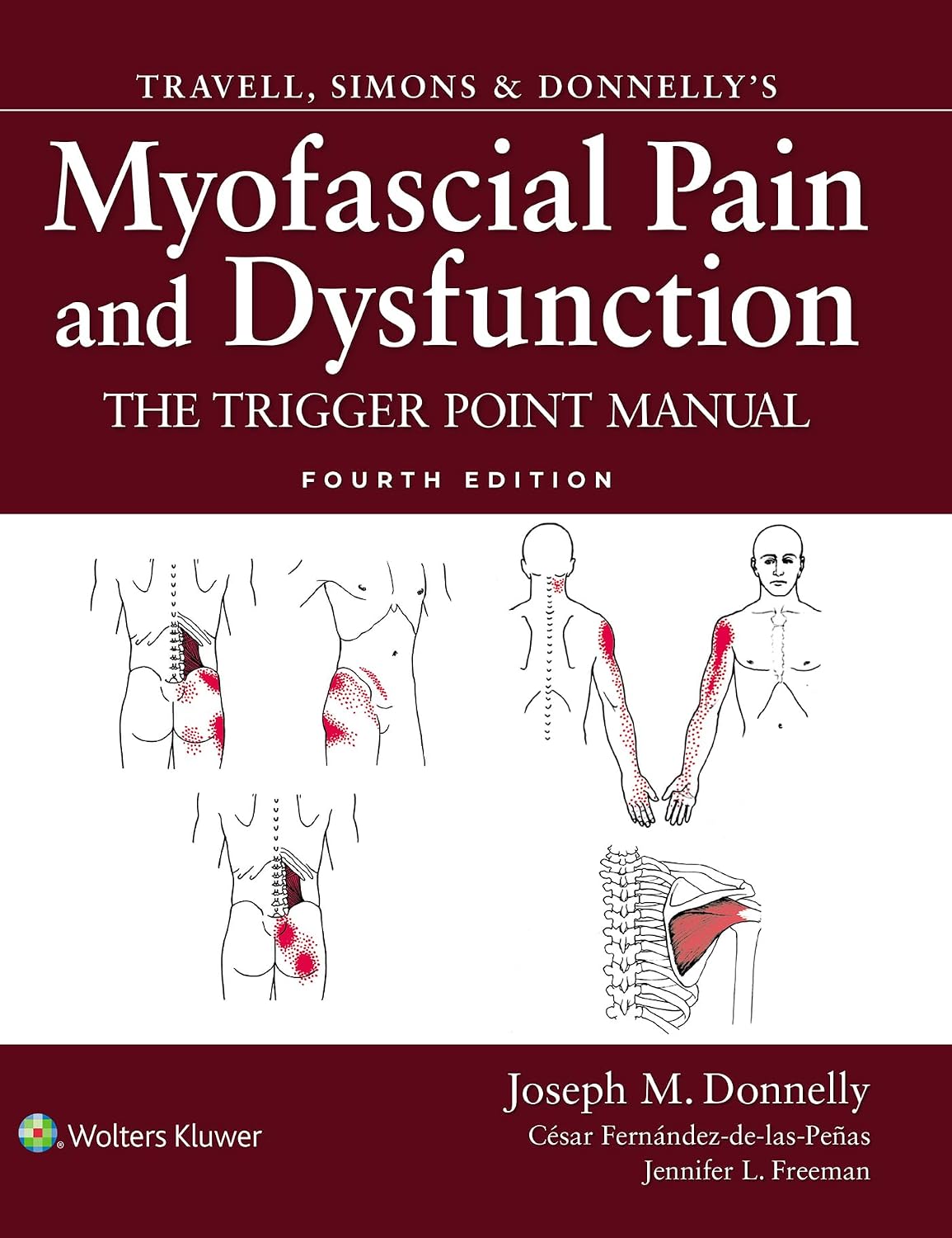 Travell, Simons & Donnelly's Myofascial Pain and Dysfunction: The Trigger Point Manual